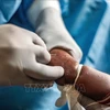 Healthcare workers are treating a young child infected with mpox in Nyiragongo, North Kivu, Democratic Republic of the Congo, on August 15, 2024. (Photo: Xinhua/VNA)