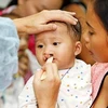 Free cleft lip, palate surgeries in Binh Dinh