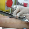 Thailand aims to eliminate AIDS by 2030