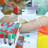 People in Hanoi get free HBV tests