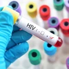 Hanoi has country’s second highest rate of HIV/AIDS