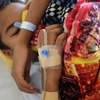 Myanmar: Dengue fever kills 48, infects over 10,700 people