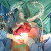 Hue Central Hospital performs record number of organ transplants