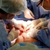 HCM City's doctors separate conjoined twins