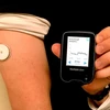 Abbott’s FreeStyle Libre system helps Vietnamese diabetes patients manage glucose