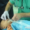 Realizan operaciones a niños con defectos labiales (Fuente:VNA)
