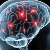 Demencia cerebro-vascular, enfermedad más frecuente en Asia