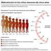 [Infografía] Malnutrición en los niños de menores de cinco años en Vietnam