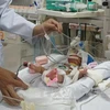 Vietnam opera con éxito quinto caso más raro del mundo con defectos del corazón