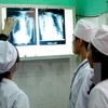Despliegan en Vietnam programa contra brote de tuberculosis