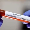 Aumentan a 49 casos infectados de coronavirus en Vietnam 