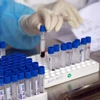 Garantizan capacidad de Vietnam de satisfacer exigencia de pruebas de coronavirus