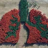 Filipinas establece récord mundial por imagen más grande del pulmón humano