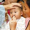 Bec-de-lièvre : opérations gratuites pour des enfants de Binh Dinh
