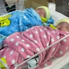 Des jumeaux survivent après une naissance prématurée, ne pesant que 500 g