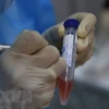 Пробы для тестирования на коронавирус. (Фото: Нам Шыонг/ВИА)