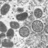 Микроскопическое изображение вируса оспы обезьян, опубликованное Центрами США по контролю и профилактике заболеваний. (Фото: AP/ВИА) 