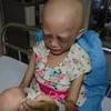 患上癌症儿童（图片来源：因特网）