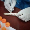10月30日越南报告新增新冠肺炎确诊病例5227例