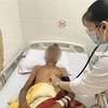 越南医生成功挽救巨大胸主动脉瘤破裂柬埔寨籍患者