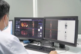 A PET/CT scan image of a patient at Cho Ray Hospital in HCM City (Photo: VNA)