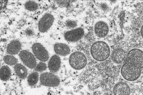 Electron microscopic image of monkeypox virus. (Photo: AFP/VNA)