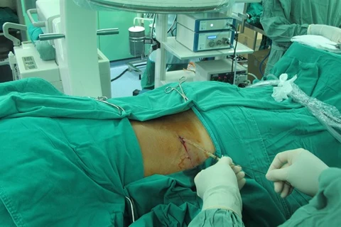 HCM City surgeons remove giant kidney stone