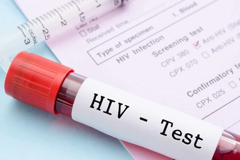New strategy needed to improve HIV treatment quality