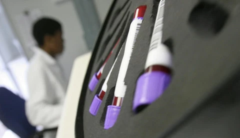 Malaysia reports sharp drop in new HIV infections