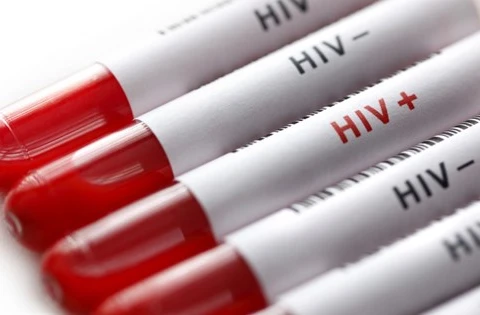 Vietnam keeps rate of new HIV cases lower 0.3 percent 