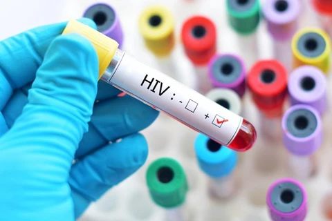 Hanoi has country’s second highest rate of HIV/AIDS