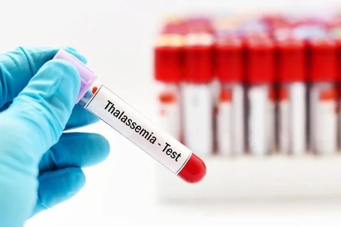 Indonesia concerned over rising thalassemia cases 