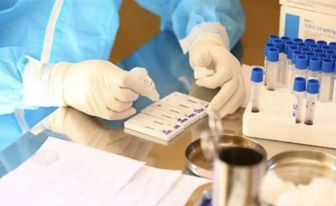 COVID-19: One imported, 93 domestic infections reported in 12 hours