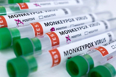 Cambodia logs three more monkeypox cases