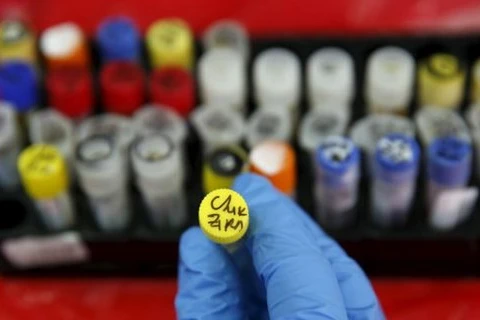 Ministerio de Salud recomienda autoprotección contra dengue y virus Zika