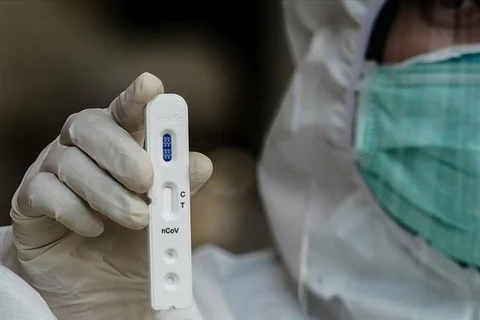Desarrolla Tailandia kits de prueba rápida del nuevo coronavirus