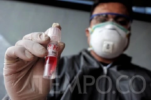 Indonesia comienza a fabricar kits de prueba rápida del COVID-19