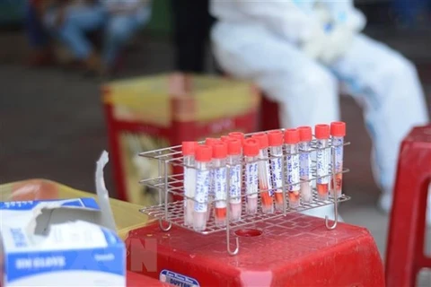 Vietnam reporta 77 casos del contagio local del coronavirus 