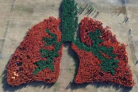 Filipinas establece récord mundial por imagen más grande del pulmón humano