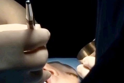 Treize chirurgiens japonais au chevet des nouveau-nés atteints de bec-de-lièvre