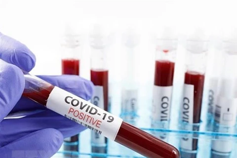 Ученые из Стэнфордской медицинской школы в США достигли успеха в тестированном обнаружении антител против вируса SARS-CoV-2, который вызывает COVID-19. (Источник: Getty Images / ВИА)
