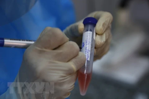 Пробы для тестирования на коронавирус. (Фото: Нам Шыонг/ВИА)