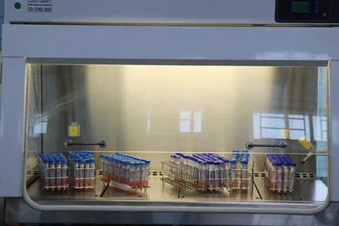 Пробы хранятся в шкафу биологической безопасности в отделении приема и обработки образцов в CDC Фу-йен. (Фото: ВИА)