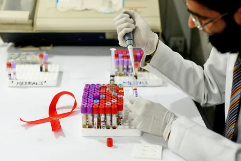 Тяжелая борьба с пандемией ВИЧ / СПИДа