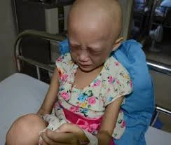 患上癌症儿童（图片来源：因特网）