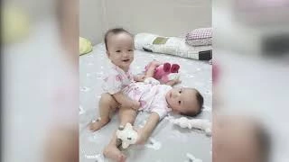 胡志明市儿童医院成功实施连体婴儿分离术 