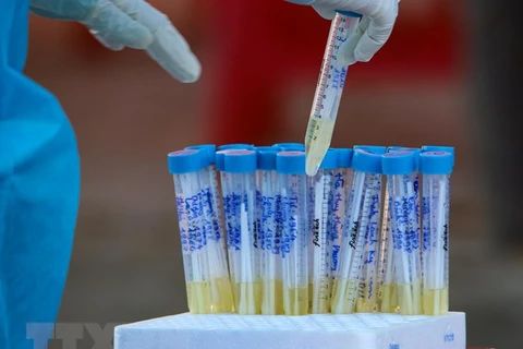越南新增一例境外输入性新冠肺炎确诊病例 连续35天无新增本地病例