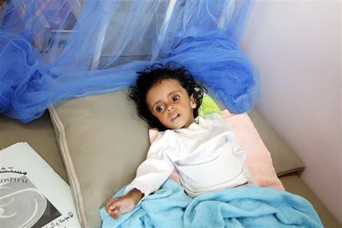 越南与联合国安理会：越南呼吁携手遏制也门饥荒危机