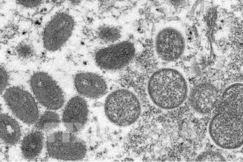 越南仍未发现猴痘病例 但将随时应对猴痘疫情爆发的风险