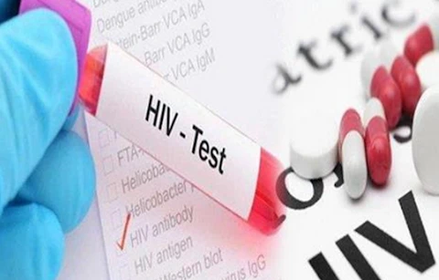 老挝艾滋病病毒感染人数增加